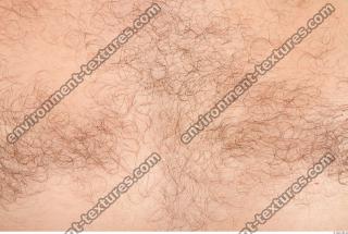 human skin hairy 0004